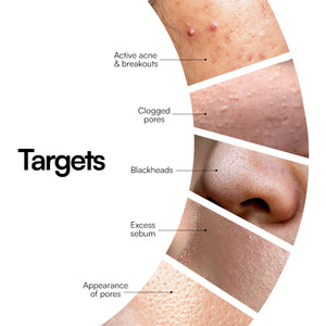 Acne Control Face Wash