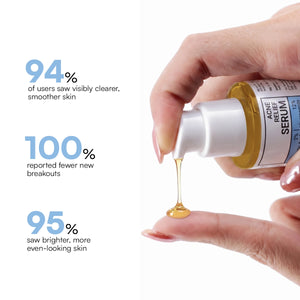Acne Relief Serum