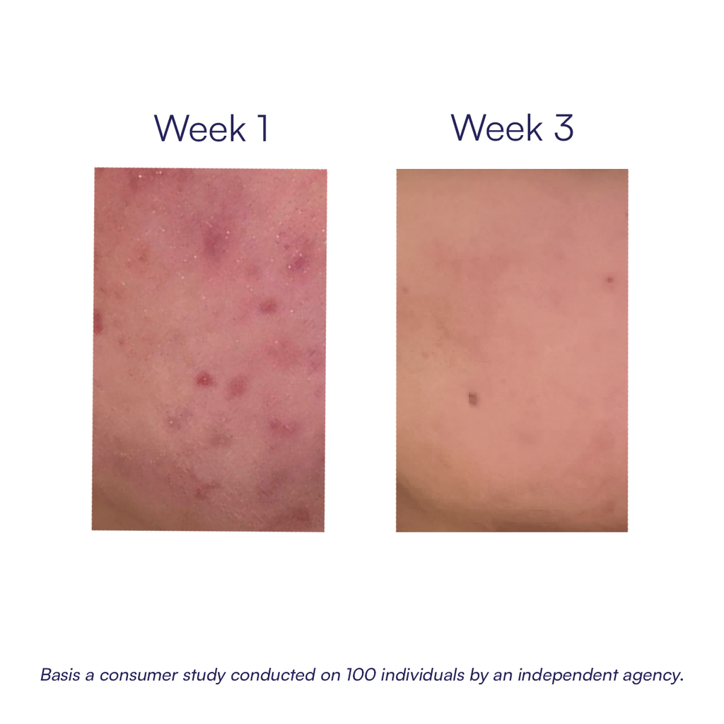 Pigmentation Correcting Serum | 30 ml