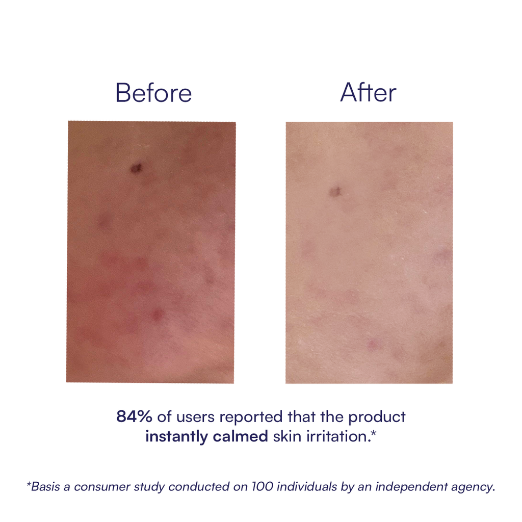 Skin Defense Mist | 100 ml